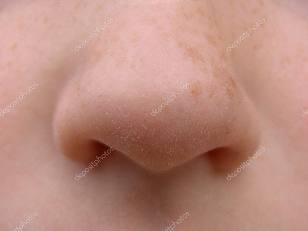 Nose Pimple