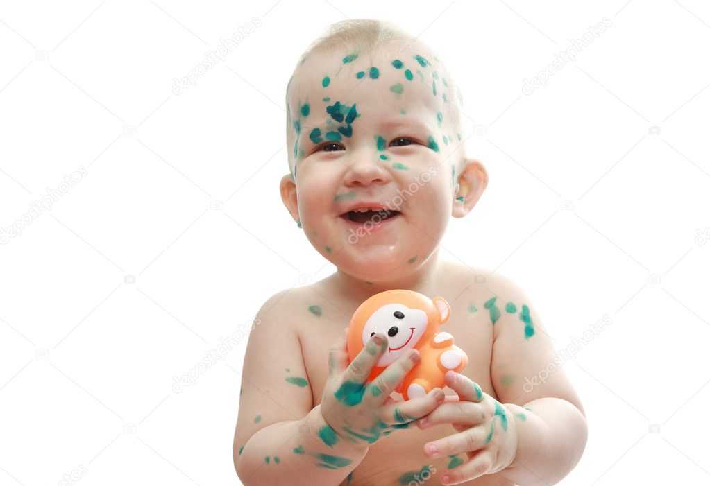 Child With Chickenpox