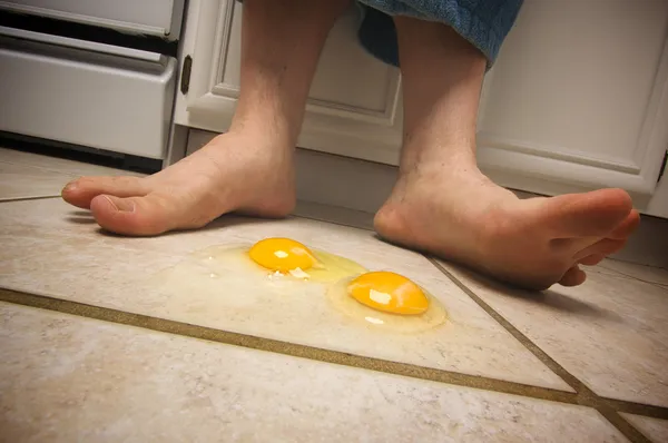 Eggs on the Floor at Mans Feet