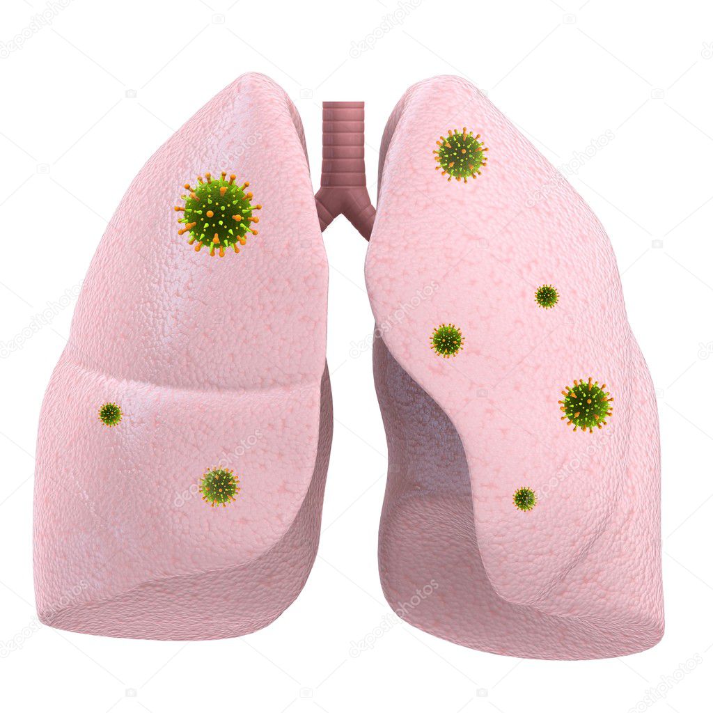 viral lung infection