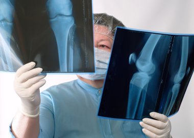 Mature doctor examining X-ray image clipart