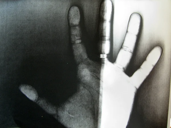 인간의 손 — 스톡 사진