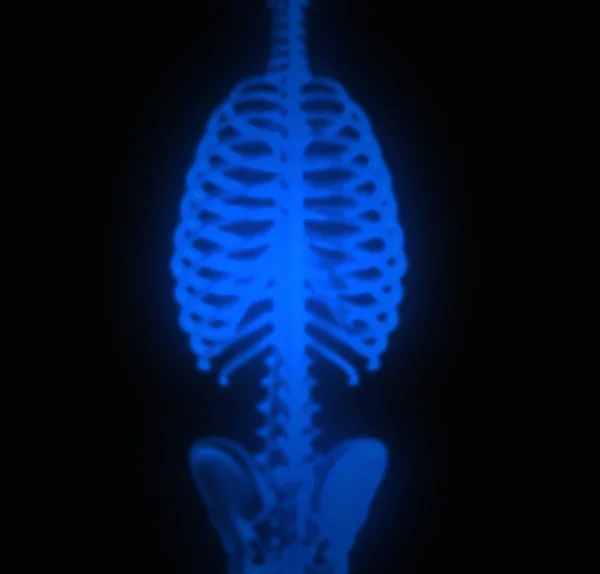 stock image x-ray body illustration