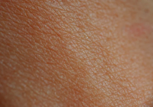 人类的皮肤 — 图库照片