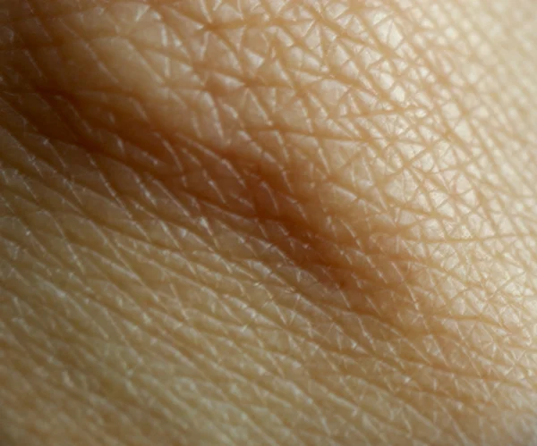 人类的皮肤 — 图库照片