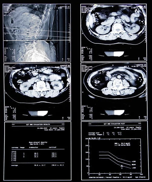 Hälsa medicinska scan — Stockfoto