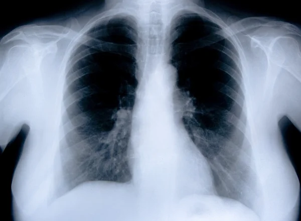 Radiografía médica de salud —  Fotos de Stock