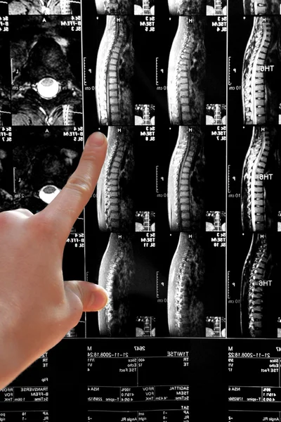Raio-X da coluna vertebral e médico Imagem De Stock