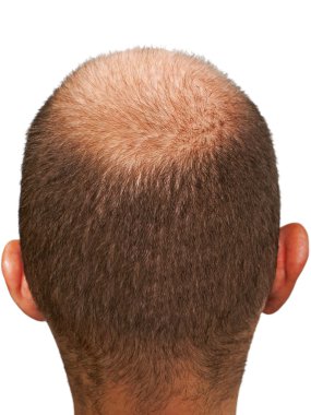 Bald head clipart