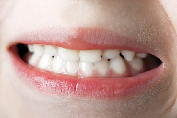Dentes macro — Fotografia de Stock