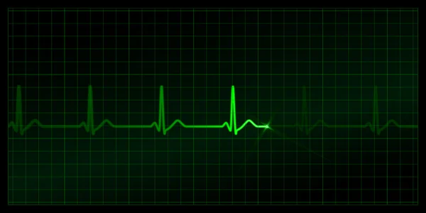 Cardiograma — Vector de stock