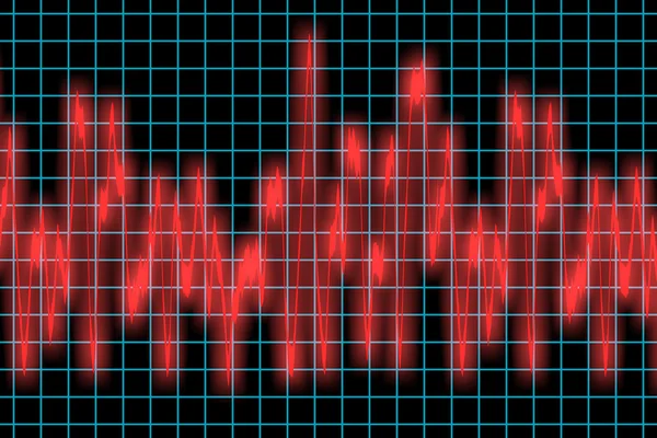 Monitor cardíaco — Fotografia de Stock