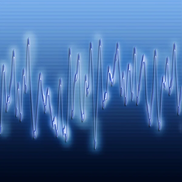 Aşırı ses dalgası — Stok fotoğraf