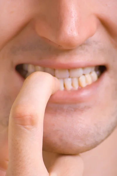 Człowiek gryzie paznokci — Zdjęcie stockowe