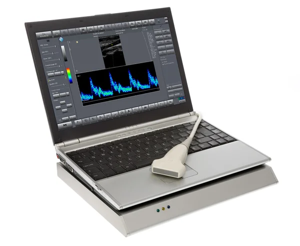Beyaz zemin üzerinde ultrason cihazları — Stok fotoğraf