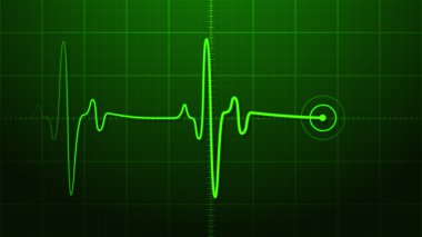 -EKG'sini Elektrokardiyogram