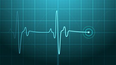 EKG - Electrocardiogram clipart