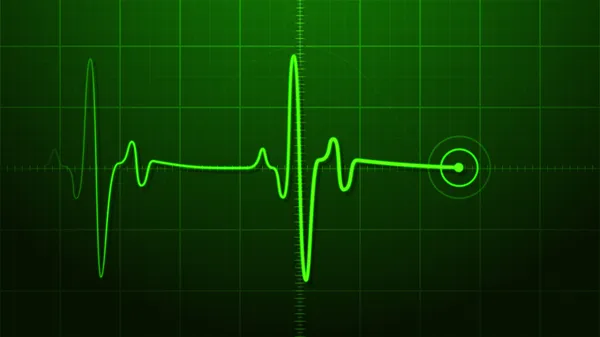 Ekg - elektrocardiogram — Stockfoto