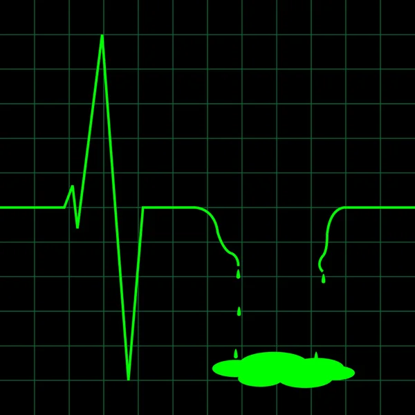Electro cardiogram illustratie — Stockvector