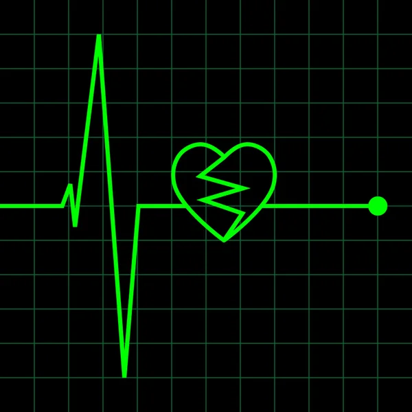 Electro Cardiogram illustration — Stock Vector
