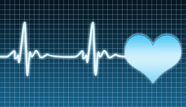 Kardiogramm des Herzens — Stockfoto