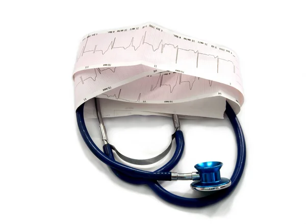 Kardiogram a stetoskopem — Stock fotografie