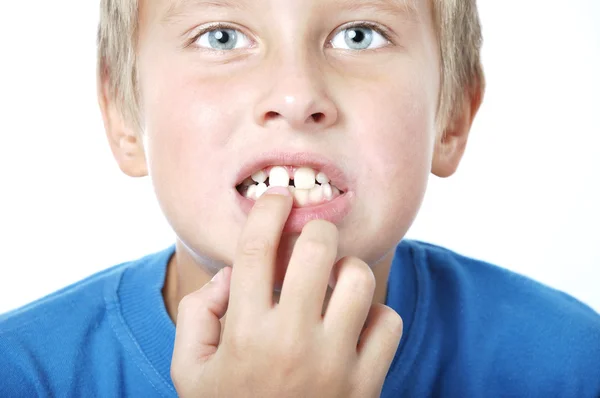 Зубчатая гримаса — стоковое фото