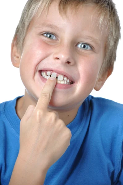 Schattige tandeloze jongen — Stockfoto