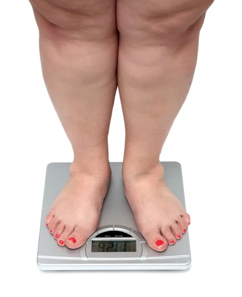 Túlsúlyos nő lába — Stock Fotó