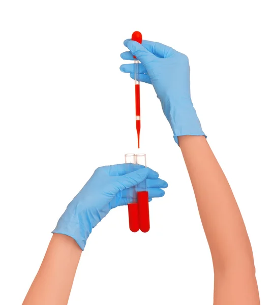 Testul de sânge — Fotografie, imagine de stoc