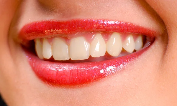 Sorriso, dentes — Fotografia de Stock