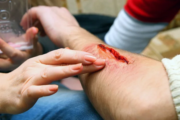 Criação de uma ferida artificial — Fotografia de Stock