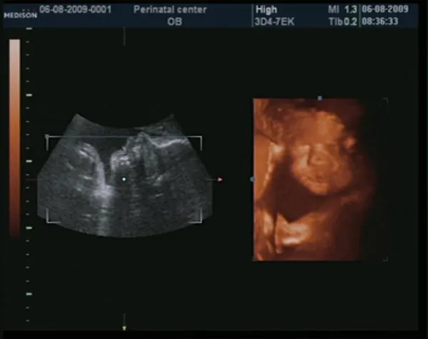 Ultrasonido de bebé 3D a las 27 semanas —  Fotos de Stock