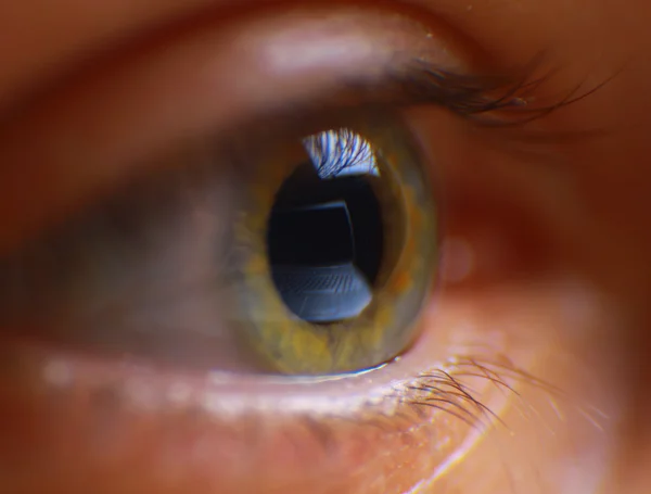 Reflection laptop in an eye — Stock Photo, Image