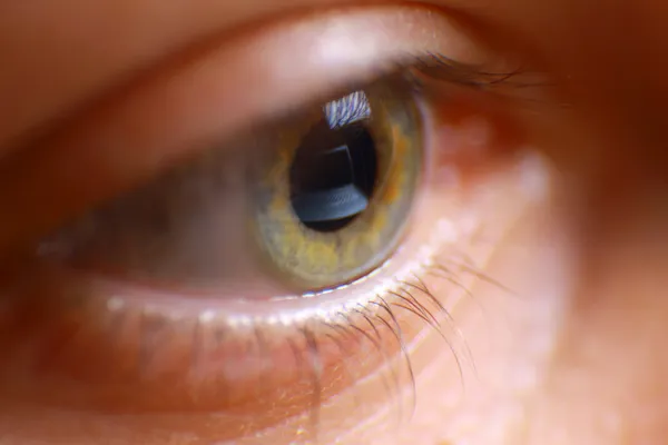 Spiegelung Laptop in einem Auge — Stockfoto
