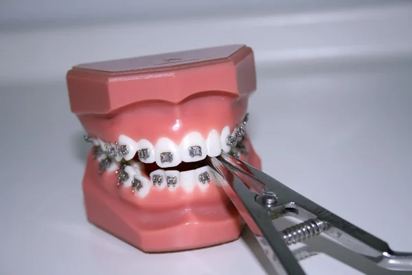 Ferramentas dentárias — Fotografia de Stock