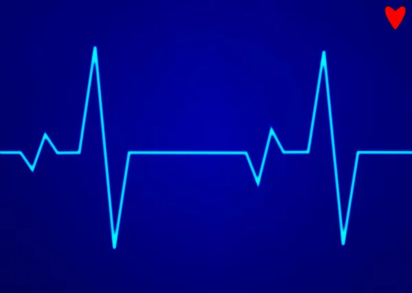 Elektronische cardiogram ecg hartslag. — Stockfoto