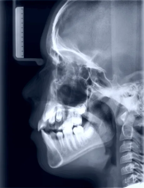 Röntgen bild av skallen av personen som — Stockfoto