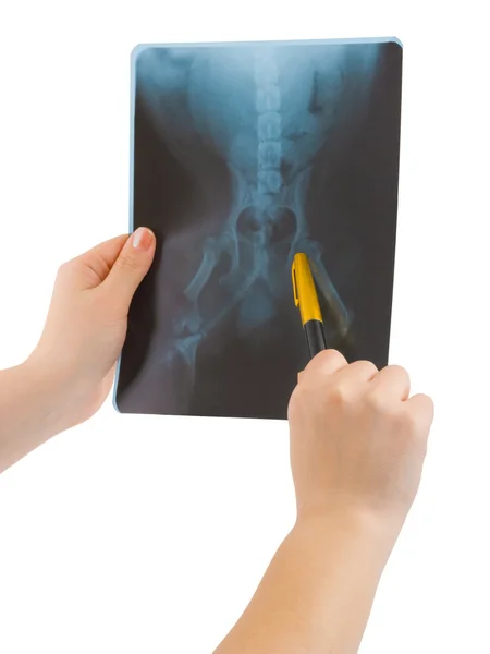 stock image X-ray in hands