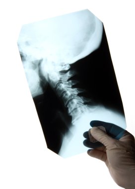 X-ray of the cervical spine clipart