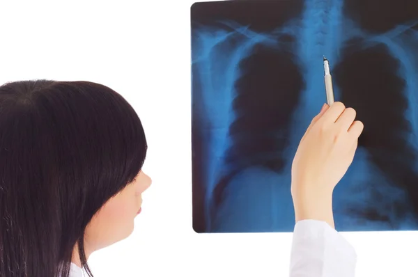 Женщина-врач смотрит на рентгеновское изображение — стоковое фото