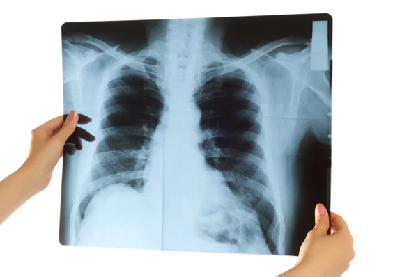 Dokter kijkt naar röntgenfoto — Stockfoto