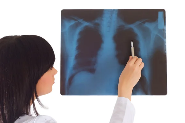 Vrouwelijke arts kijkt naar x-ray — Stockfoto