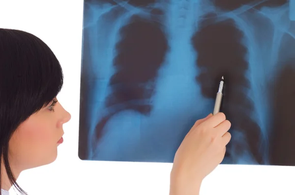Kvinnlig läkare tittar på röntgen — Stockfoto
