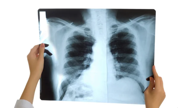 Az orvos a röntgenképet nézi. — Stock Fotó