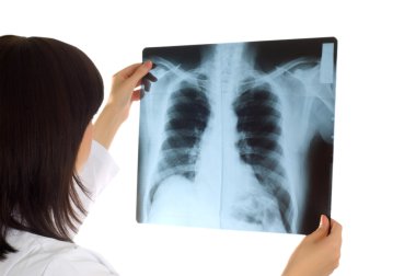 Female doctor looking at x-ray image clipart