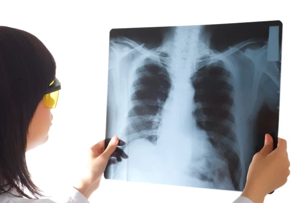 Kobieta lekarz patrząc na rentgen — Zdjęcie stockowe
