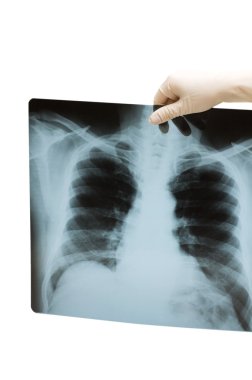 el x-ray görüntü tutarak