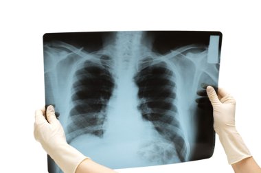 iki eli x-ray görüntü holding