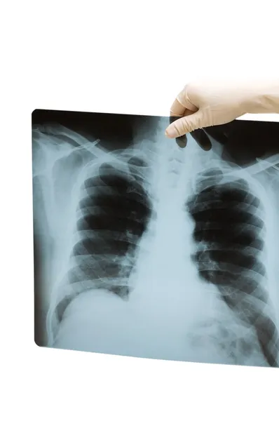 Hand met x-ray afbeelding — Stockfoto